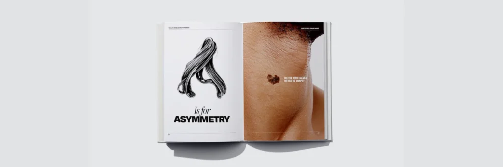 barber and melanoma cancer