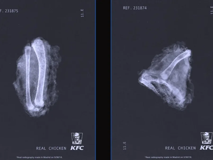 kfc x ray
