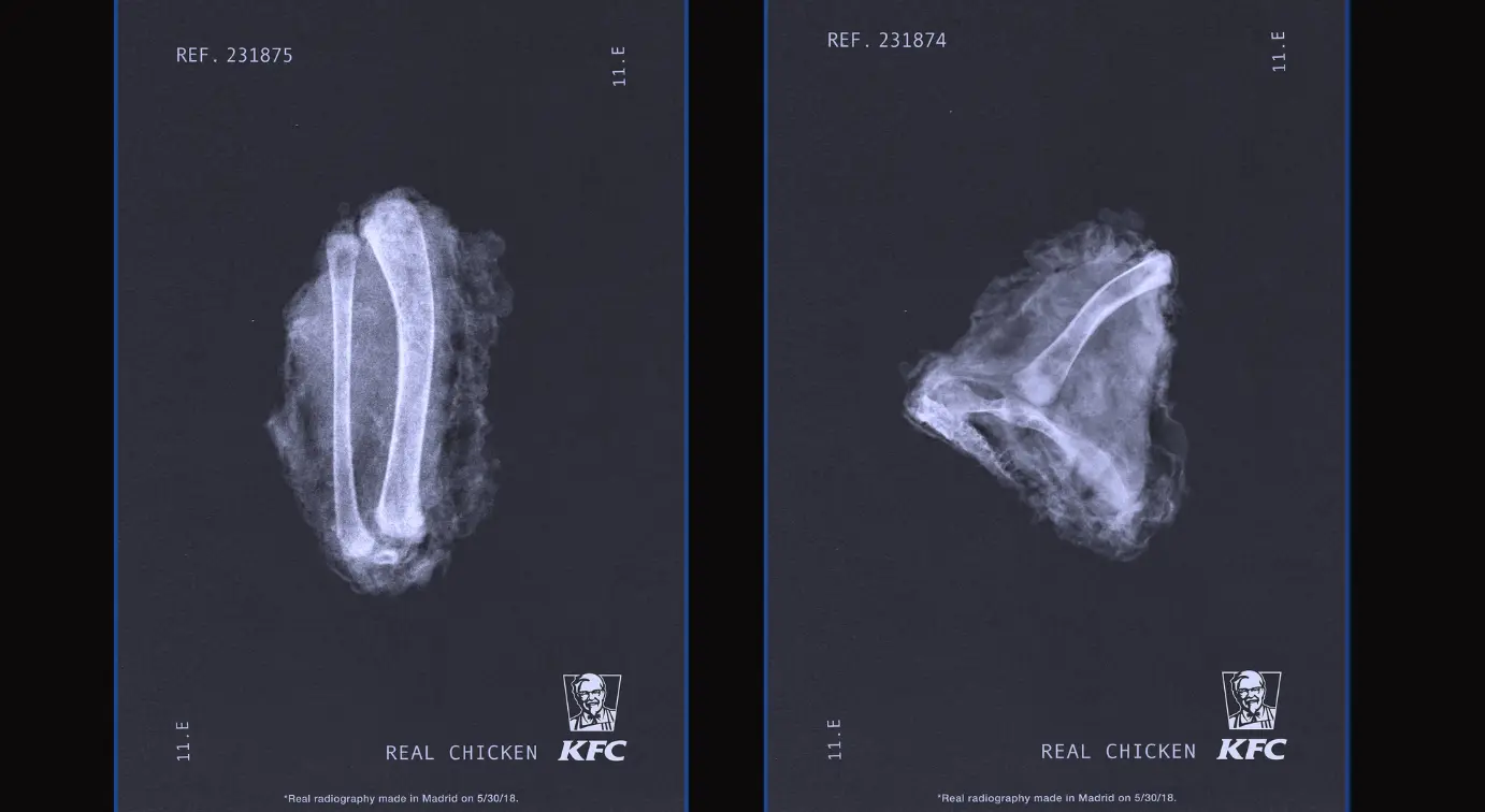 kfc x ray